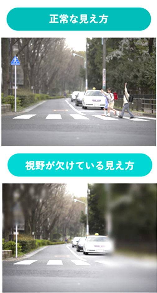 緑内障の正常な見え方と視野が欠けている見え方の比較写真。視野がかけている写真は脳の補正がかかり横断歩道の子どもたちが消えています。