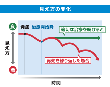 治療を継続し再発を予防した場合と、再発した場合の見え方の変化をグラフにしています。適切な治療を続けると治療開始時より見え方が悪化することはありませんが、再発してしまうとどんどん見え方が悪くなります。一度悪くなった見え方は回復しない事も多いので、適切な治療を継続することが重要ということがわかります（松風たかぎ眼科）